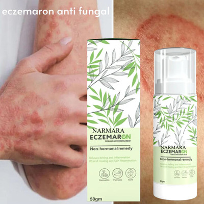 NARMARA Herbal Eczemaron Cream Pack Of(50 g)