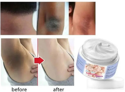 GULGLOW99 Lightening & Whitening Cream For Bikini Area(50 g)