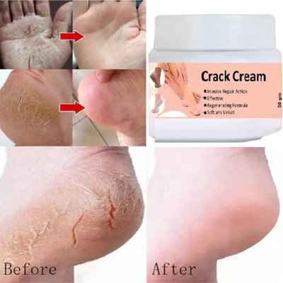 HUZURLU Cream for Feather Soft Feet(50 g)