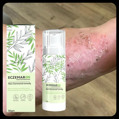 BUZIVENTURES Eczemaron Anti Fungal Treatment for Sensitive Skin_MZ146(50 g)