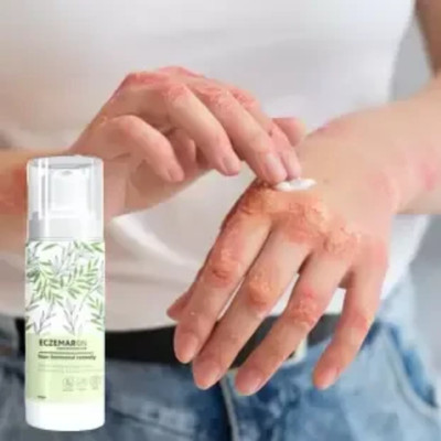 Elatiz Eczemaron Anti-Fungal Cream: Rapid Healing for Skin cream 0.1(50 ml)