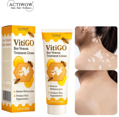 ACTIWOW Vitigo Bee Venom Cream for Dry Skin Relief cream Moisturizer(100 g)