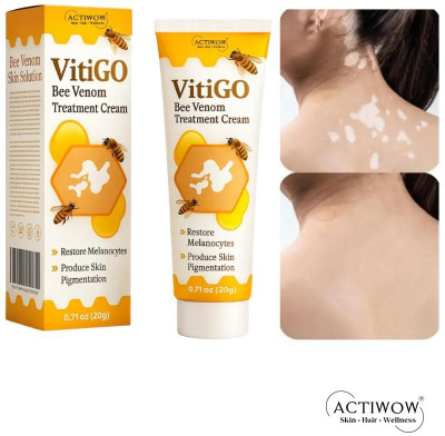 ACTIWOW Vitigo Bee Venom Cream for Soft Radiant Look Cream Moisturizer(100 g)