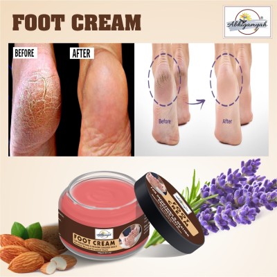 ABHIGAMYAH Cracked Rough Stressed and Fungus of Heels and Feet Cream Ultra Healing (100g)(100 g)