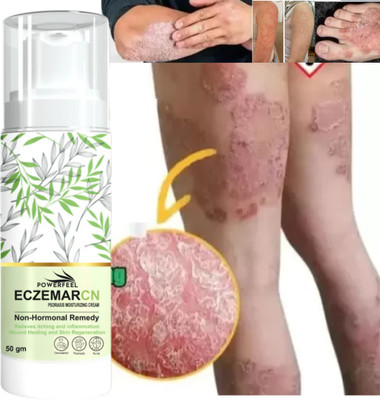 POWERFEEL Eczemaron Anti Fungal Cream For Men & Women(50 ml)