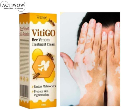 ACTIWOW Vitigo Bee Venom Cream for Gentle Glow Renewal Cream Moisturizer(100 g)