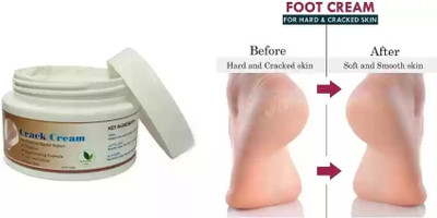 AFARAXIA Crack Cream For Dry Cracked Heels & Feet(50 g)