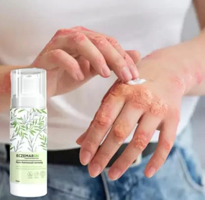 Deeparth ECZEMA CREAM FOR MEN & WOMEN (PACK OF 1) (50 g)(50 g)