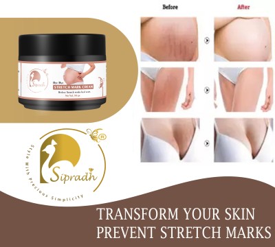 Sipradh Stretch Marks Scar removal cream during after pregnancy delivery women(50 g)