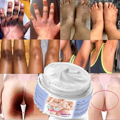 luzimaisa Bikini Lines Intimate Area Skin Softens Moisturize Cream(50 g)
