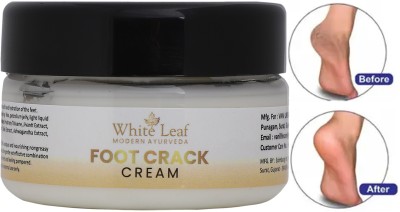 White Leaf Foot Cream Crack Peeling Repair Anti Dry Skin Remove Dead Skin Foot Moisturizing(50 g)