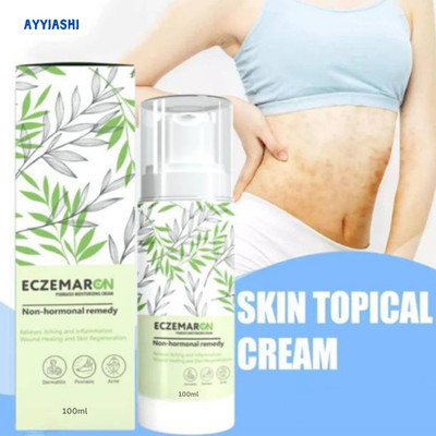AYYIASHI Eczemaron Soft Touch Cream For Smooth And Healthy Skin(100 ml)