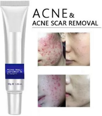 REIMICHI Acne Cream For Oily Acne Prone & Sensitive Skin(30 g)