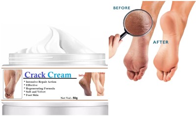 YAWI Foot Crack Cream For Dry Cracked Heels & Feet(50 g)