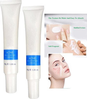 tanvi27 Oil Control Moisturizing Smooth Skin Anti-Acne Cream Combo(60 ml)