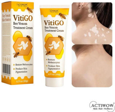 ACTIWOW Vitigo Bee Venom Cream for Redness Reduction cream Moisturizer(100 g)