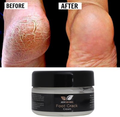 JOYHERBS Foot Crack Cream Crack Blaster Repair - Cracked Skin, Heel(50 g)
