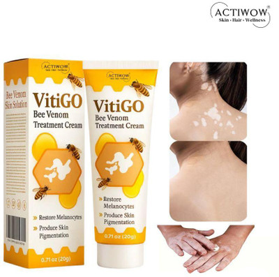 ACTIWOW Vitigo Bee Venom Cream for Lightweight Evening Layer cream Moisturizer(100 g)