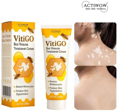 ACTIWOW Vitigo Bee Venom Cream for Long-Lasting Hydration cream Moisturizer(100 g)