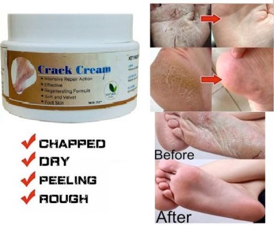 ADJD Foot Care Cream Repairs Cracked Heel For Women & Men(50 g)