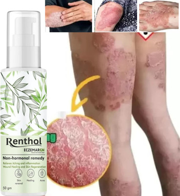 Renthol Eczemaron Anti Fungal Cream For Men & Women ItchCoat-Eczema cream(50 g)