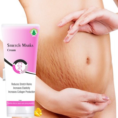 wvhc stretch Cream for Stretch Marks Removal Post Pregnancy fast work(50 g)