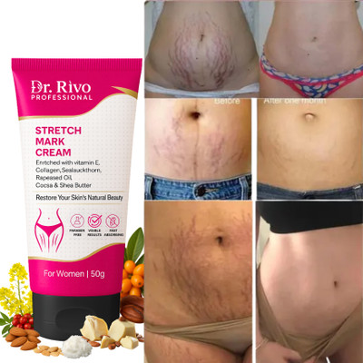 Dr rivo professional Advanced Herbal Formula for Stretch Marks Removal and Skin Elasticity(50 g)