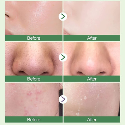 Wonholli Blackheads, Whiteheads Solid Clay Detox Mud Mask(40 g)