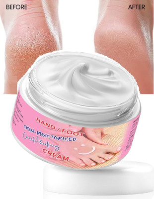 YAWI foot crack cream for dry cracked heels(50 g)