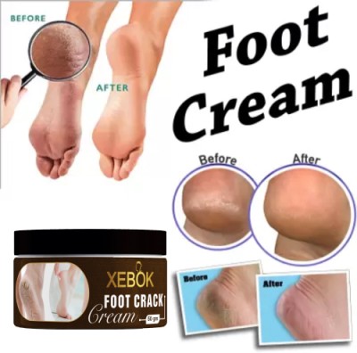 Xebok Feet crack heel repair cream Smooth Foot Crack Cracked cream (50 g)(50 g)