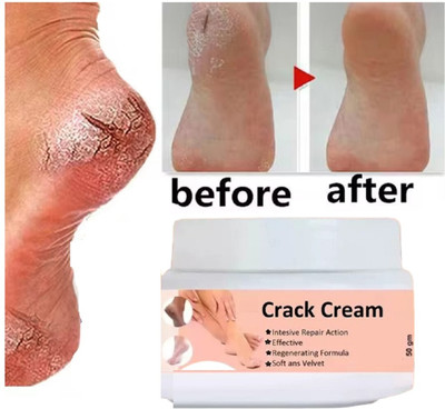 Jiwoo Feet Crack Heel Repair Cream for Moisturizes and Soothes Feet for Men & Women(50 g)