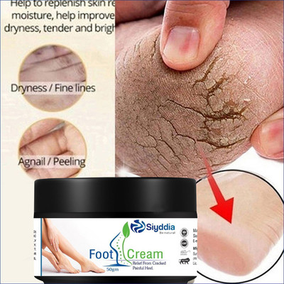 SIYDDIA feet crack heel repair cream Smooth Foot Crack Cracked Heel Repair Foot Cream(50 ml)