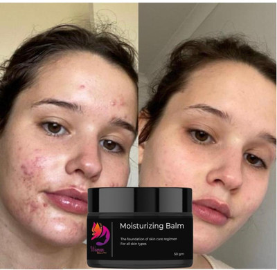 Woman Beauty Glow Pro Instant Glow Face Moisturizer for Men 50 GM(50 g)