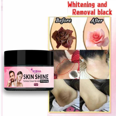 vexana Whiting Cream for Dark Spots, Brightening Bikini Area ,Underarms(50 g)