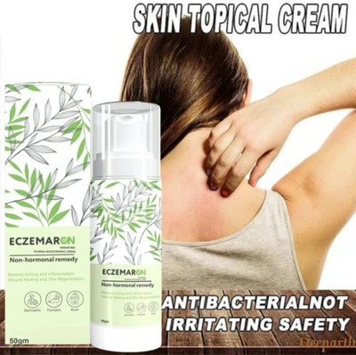 Deeparth Eczemar On Anti Fungal Cream For Men & Women -/ Pack of 1(50 g)