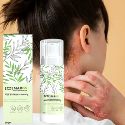 Treszo Herbal Eczemaron Cream Pack Of 1.1(50 ml)