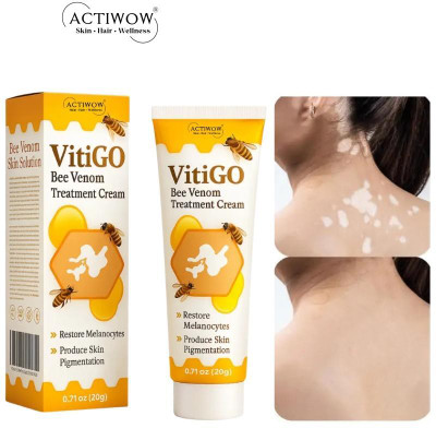 ACTIWOW Vitigo Bee Venom Cream for Patch Care X001(100 g)