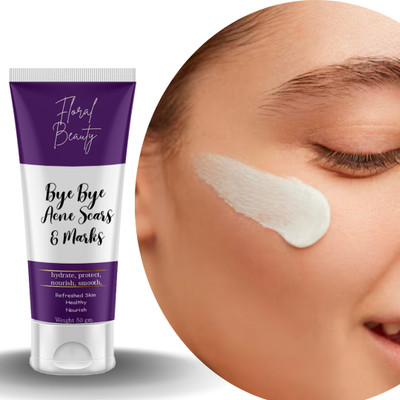 FLORAL BEAUTY BYE BYE ACNE SCARS & MARKS CREAM TUBE FB | CREAM FOR HYDRATING & SMOOTH SKIN(100 ml)