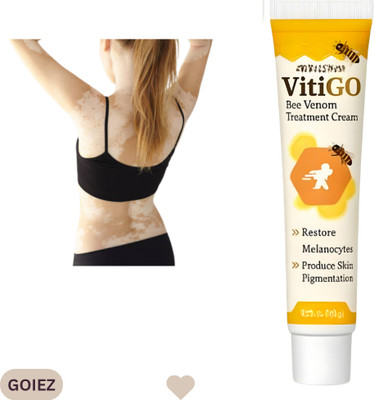 GOIEZ Vitiligo Patch Calm Treatment Venom Cream Pack Of 1 (30g)(30 g)