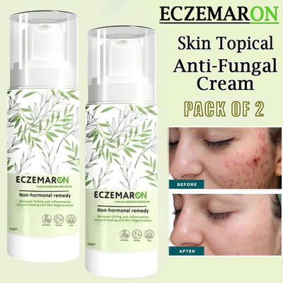 PANARO Natural Eczemaron Fungal Cream for Fast-Acting Skin Relief(100 g)