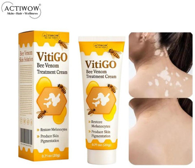ACTIWOW Vitigo Bee Venom Cream for Everyday Radiant Skin Cream Moisturizer(100 g)
