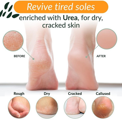 SUBIA PRFECTIONAL FOOT REPAIR CRACK CREAM(50 g)