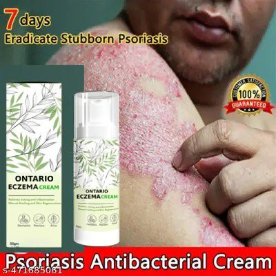 Ontario ECZEMA CREAM MEN & WOMEN (PACK OF 1)(50 g)