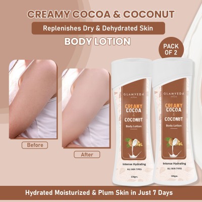 GLAMVEDA Cocoa Butter & Almond Oil Intense Hydrating Body Lotion ( Pack Of 2)(200 ml)