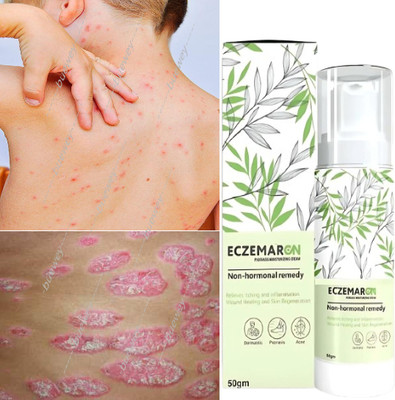 buewey Cream for Anti-Fungal Infection ,Itching & Skin Recovery(50 ml)