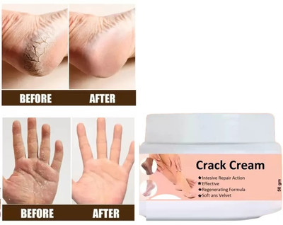 HUZURLU Foot Crack Cream(50 g)