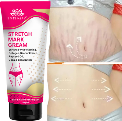 INTIMIFY Stretch marks cream for women, Used For Post Pregnancy Scars(50 g)