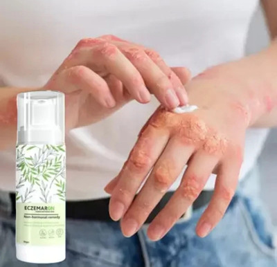 Deeparth Eczemaron Anti Fungal Cream For Men & Women 50g(50 g)