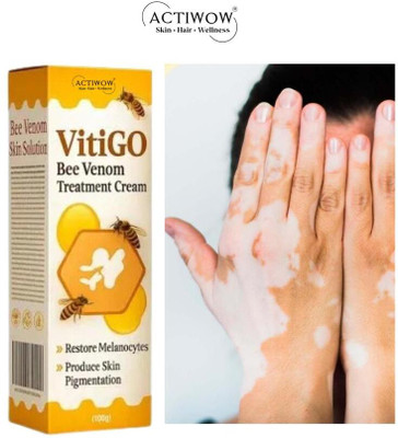 ACTIWOW Vitigo Bee Venom Cream for Smooth Skin Glow Cream Moisturizer(100 g)
