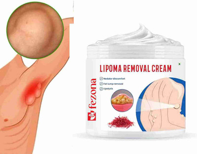 FEZONA Herbal Lipoma Removal Cream Mild Easy to Use Care Cream(100 ml)